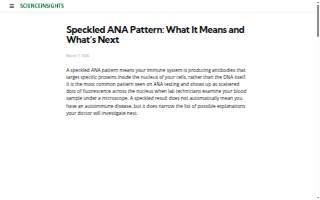 Speckled Ax website