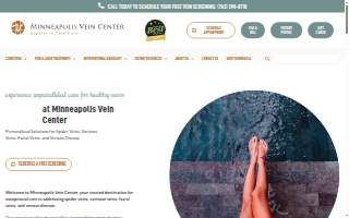 Minneapolis Vein Center website