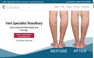 Minnesota Vein Center website