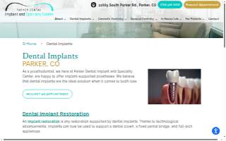 Parker Dental Implant and Specialty Center website