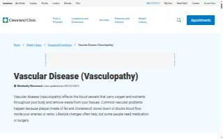 Vascular Surgery - Covington - St. Elizabeth Physicians website