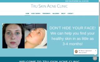 Tru Skin Acne Clinic website
