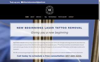 New Beginnings Laser Tattoo Removal website