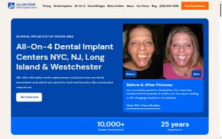 All On Four Dental Implants New Jersey website