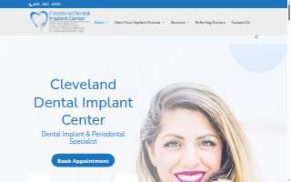 Cleveland Dental Implant Center website