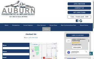Auburn Periodontics & Implantology website