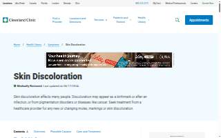 Mark D Esarey, OD website