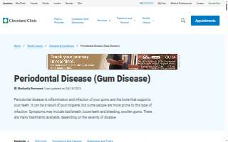 Periodontal Specialists of Indiana PSI website