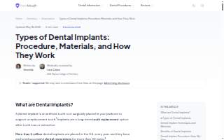 Implant Dentistry and Periodontics - Fishers website